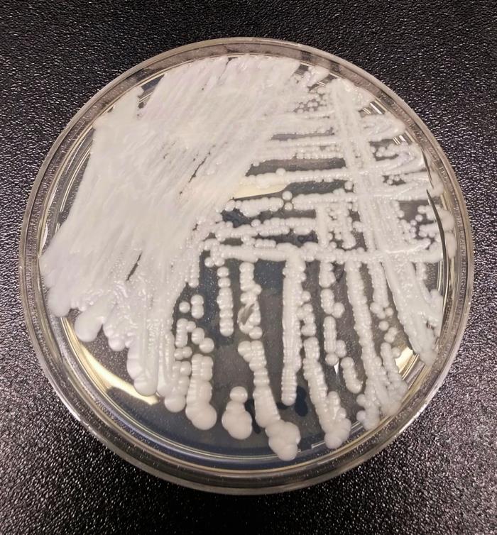 CDC says drug-resistant infections and deaths have climbed since its last full report