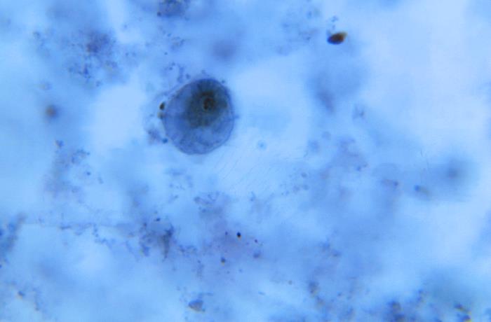 Details - Public Health Image Library(PHIL)
