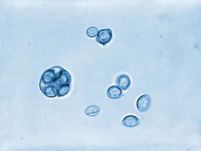 Details - Public Health Image Library(PHIL)