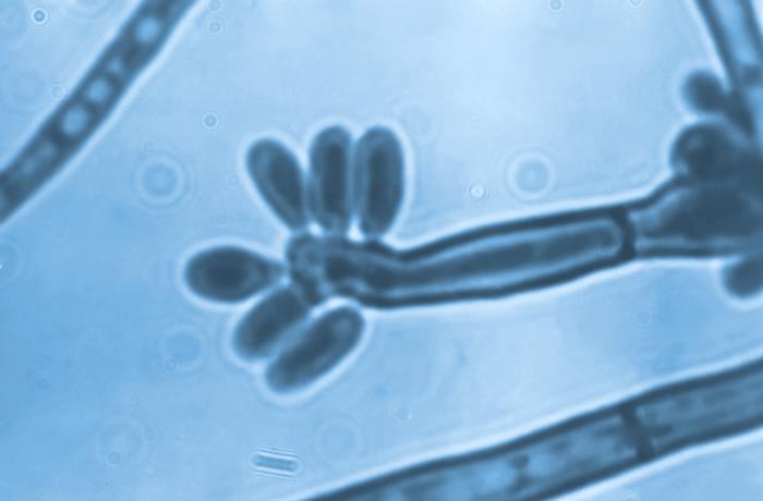 Details - Public Health Image Library(PHIL)