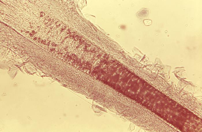 Details - Public Health Image Library(PHIL)