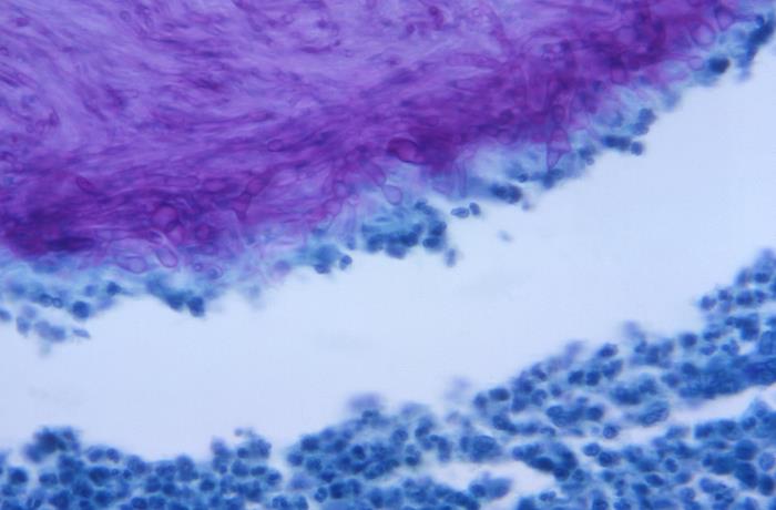 Details - Public Health Image Library(PHIL)