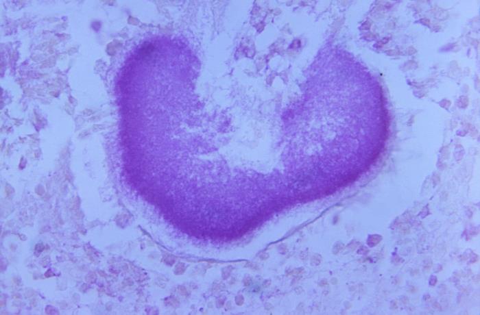 Details - Public Health Image Library(PHIL)