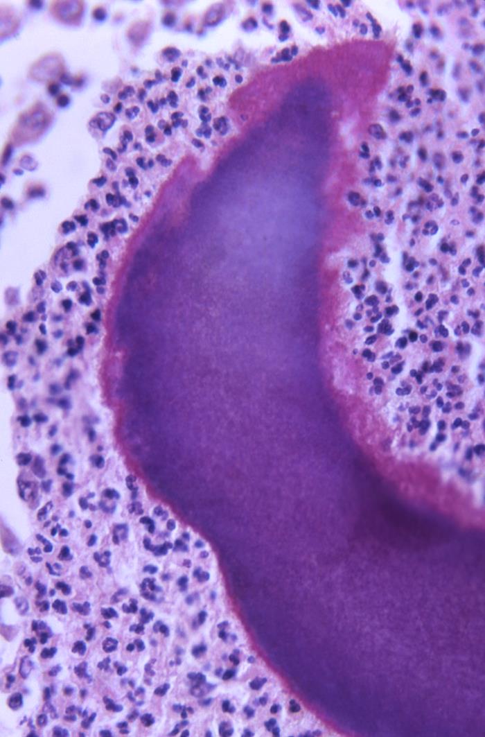 Details - Public Health Image Library(PHIL)