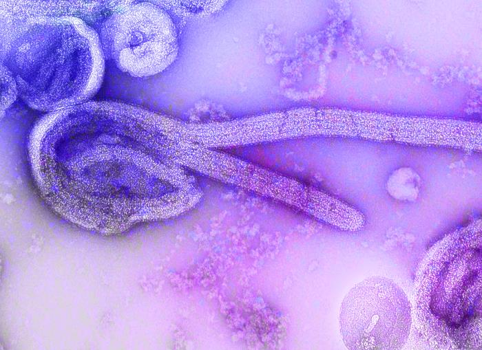 Colorized electron micrograph of Ebola virus particles