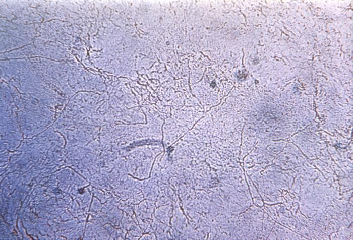 Details - Public Health Image Library(PHIL)