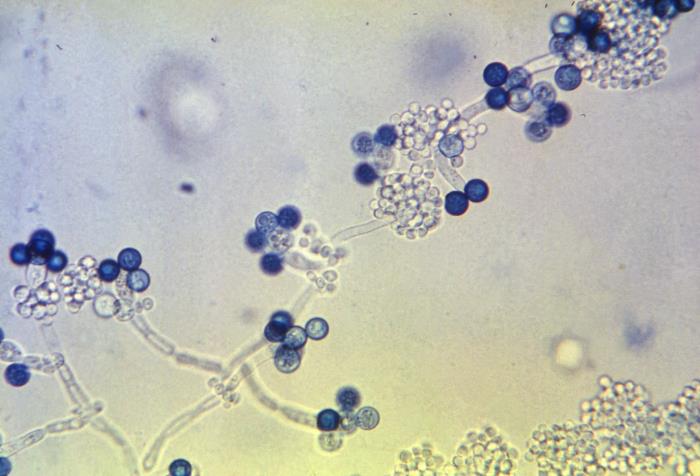 Details - Public Health Image Library(PHIL)