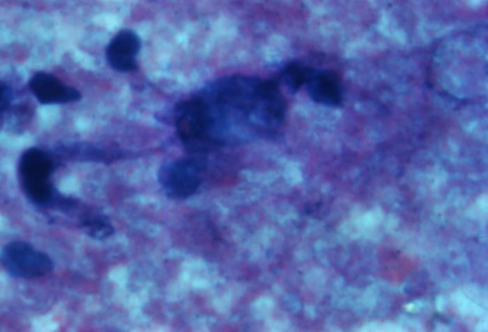 Rabies Inclusions Details - Public Health Image Library(PHIL)