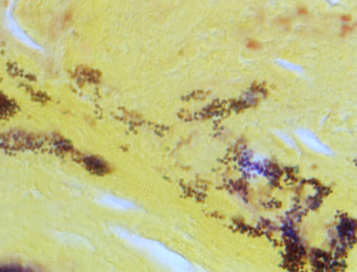 Stained Specimen Details - Public Health Image Library(PHIL)