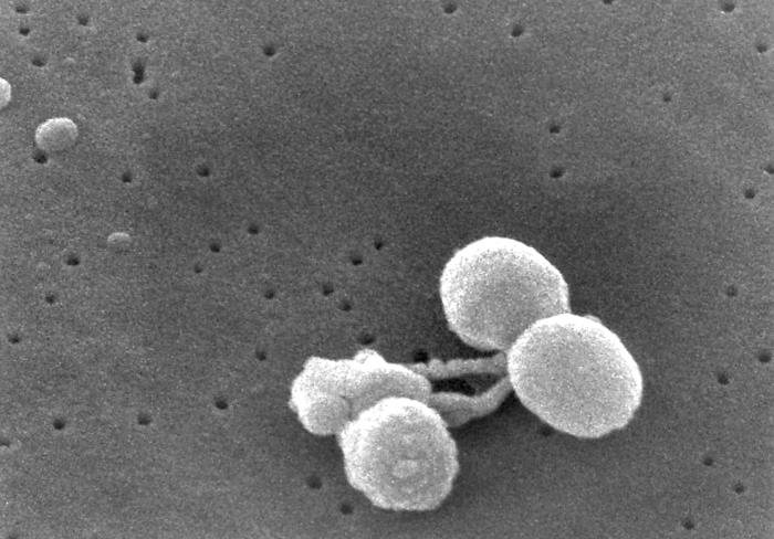 Details - Public Health Image Library(PHIL)