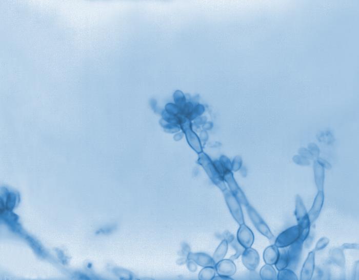 Details - Public Health Image Library(PHIL)