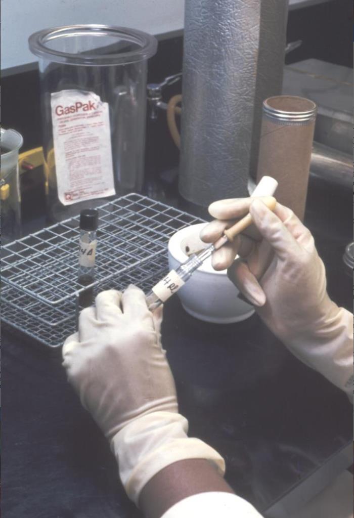 Details - Public Health Image Library(PHIL)