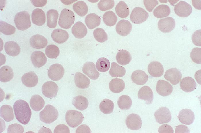 Details - Public Health Image Library(PHIL)
