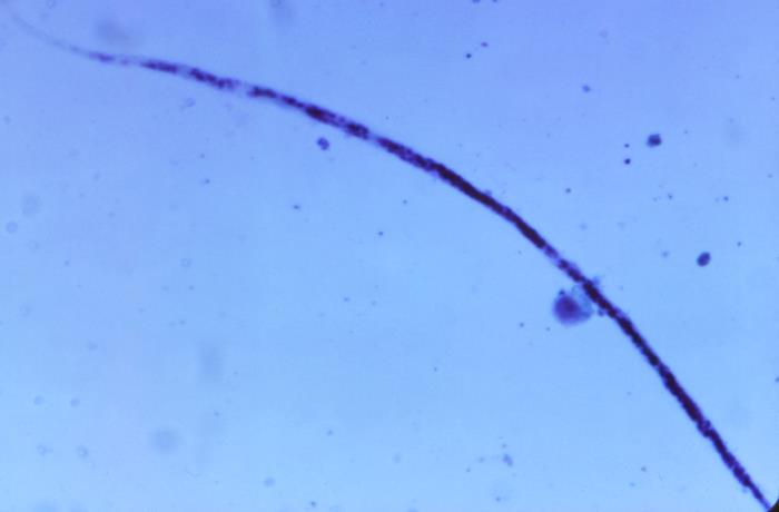 Microlaria Microscope Details - Public Health Image Library(PHIL)