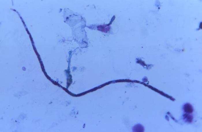 Microlaria Microscope Details - Public Health Image Library(PHIL)