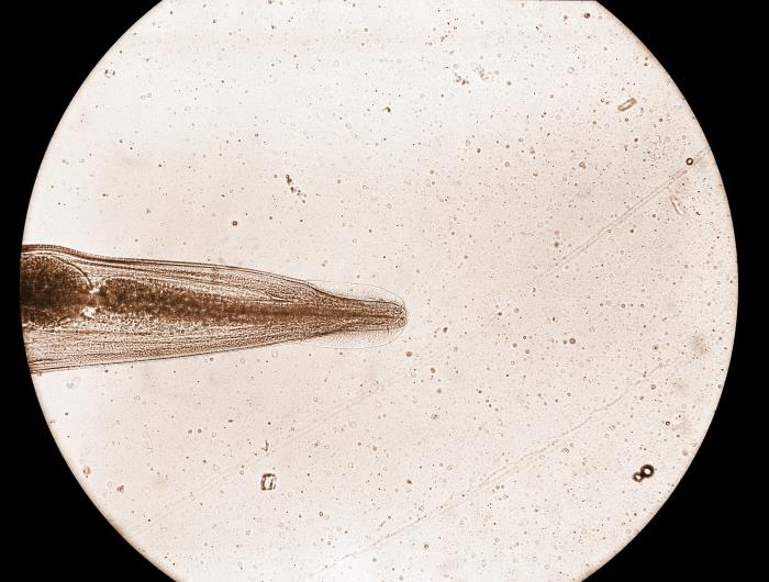 رأس الدودة الدبوسية Enterobius vermicularis تحت المجهر