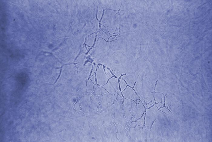 Details - Public Health Image Library(PHIL)