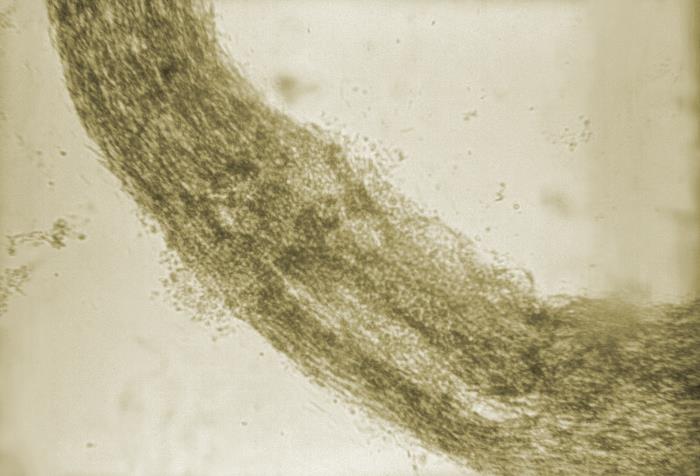 Details - Public Health Image Library(PHIL)