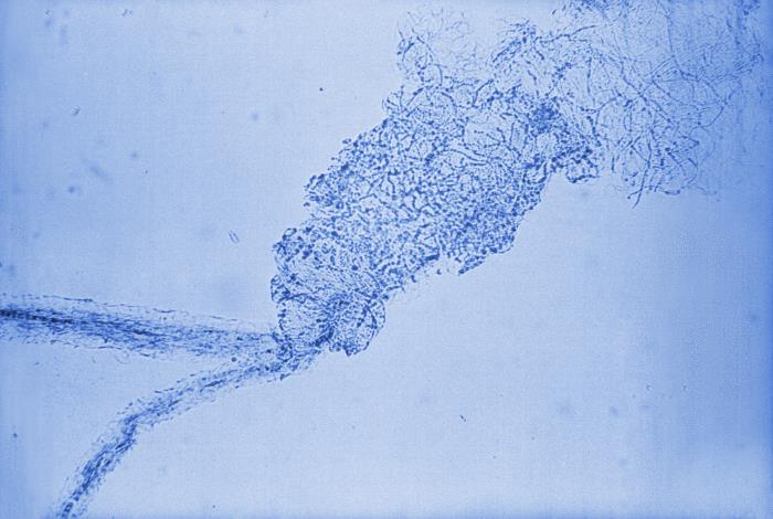 Details - Public Health Image Library(PHIL)