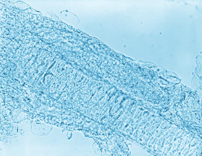 Details - Public Health Image Library(PHIL)