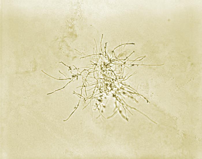 Pathologic Spider Details - Public Health Image Library(PHIL)