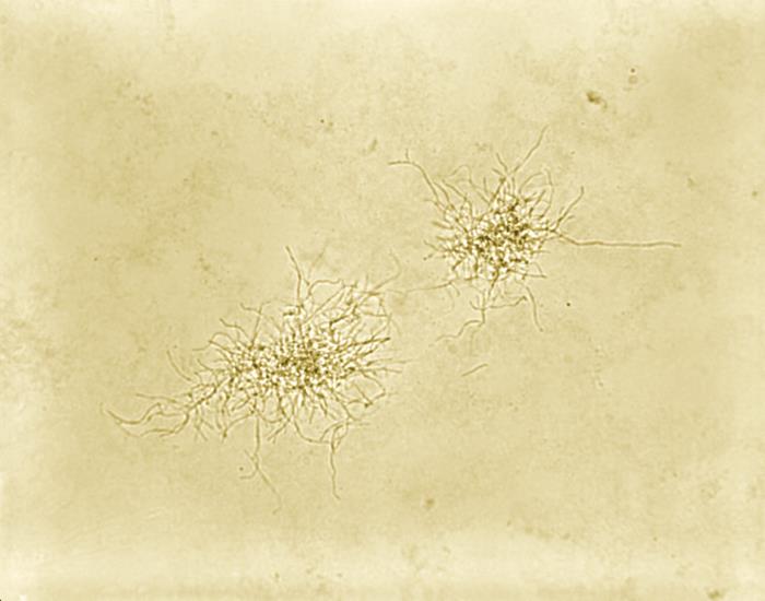 Pathologic Spider Details - Public Health Image Library(PHIL)