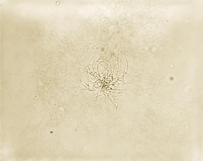 Pathologic Spider Details - Public Health Image Library(PHIL)