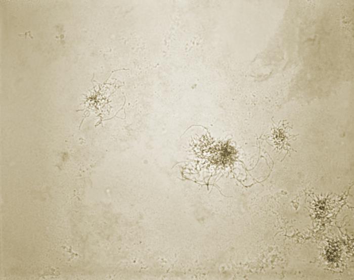 Pathologic Spider Details - Public Health Image Library(PHIL)