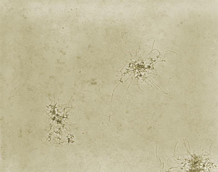 Pathologic Spider Details - Public Health Image Library(PHIL)