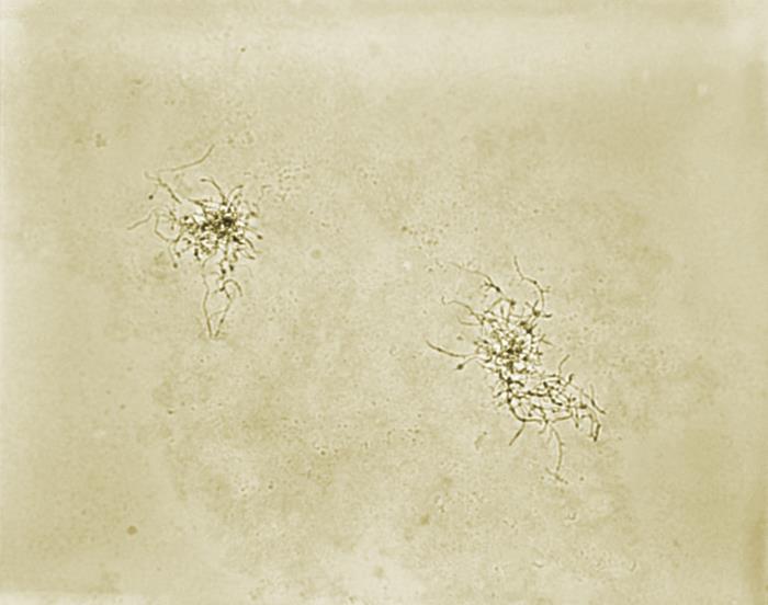 Pathologic Spider Details - Public Health Image Library(PHIL)