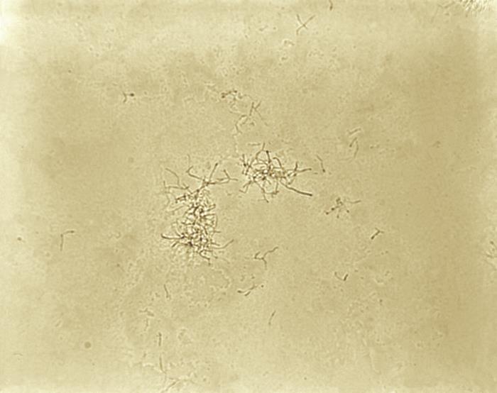Pathologic Spider Details - Public Health Image Library(PHIL)