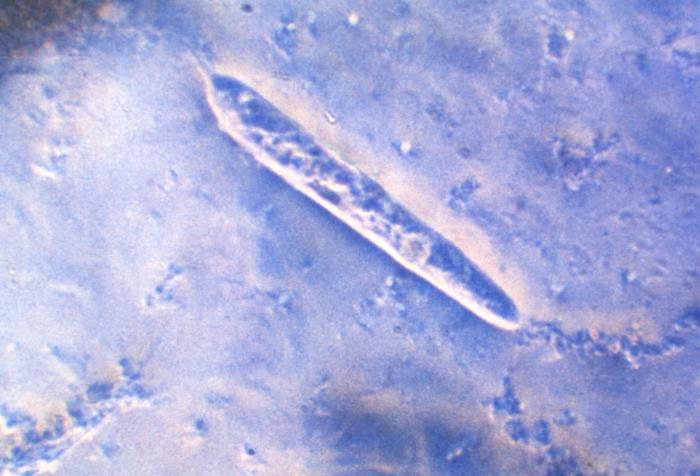 Microlaria Microscope Details - Public Health Image Library(PHIL)