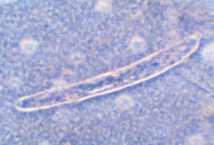 Microlaria Microscope Details - Public Health Image Library(PHIL)