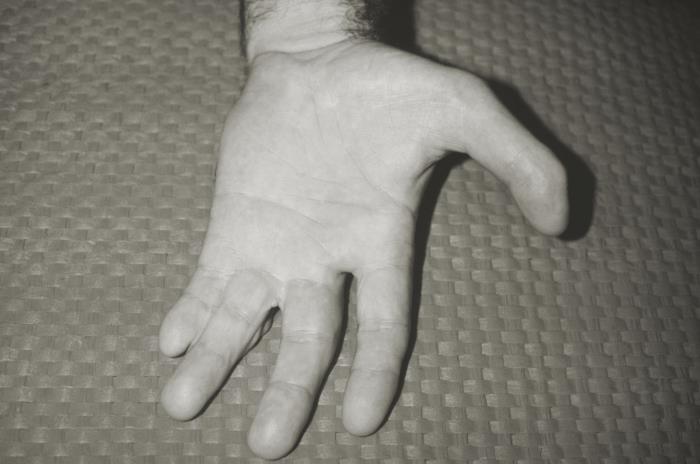 Details - Public Health Image Library(PHIL)