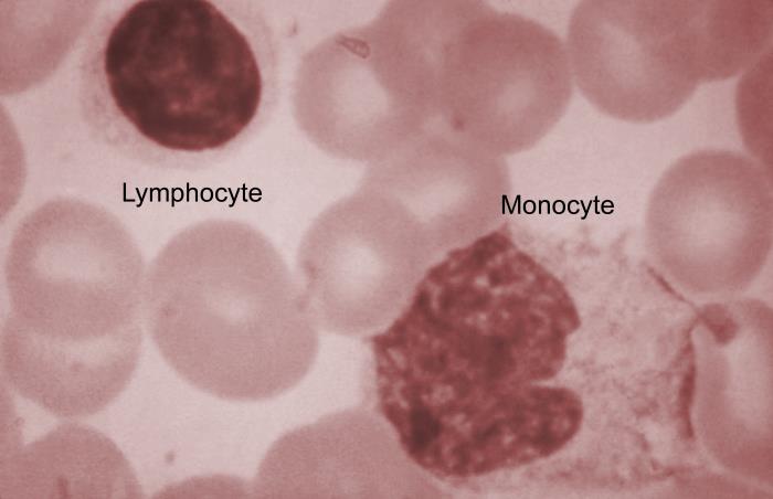 Details - Public Health Image Library(PHIL)