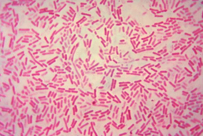Details - Public Health Image Library(PHIL)