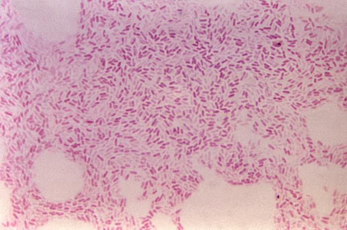 Details - Public Health Image Library(PHIL)