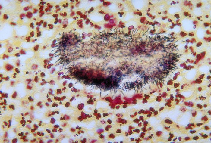 Details - Public Health Image Library(PHIL)