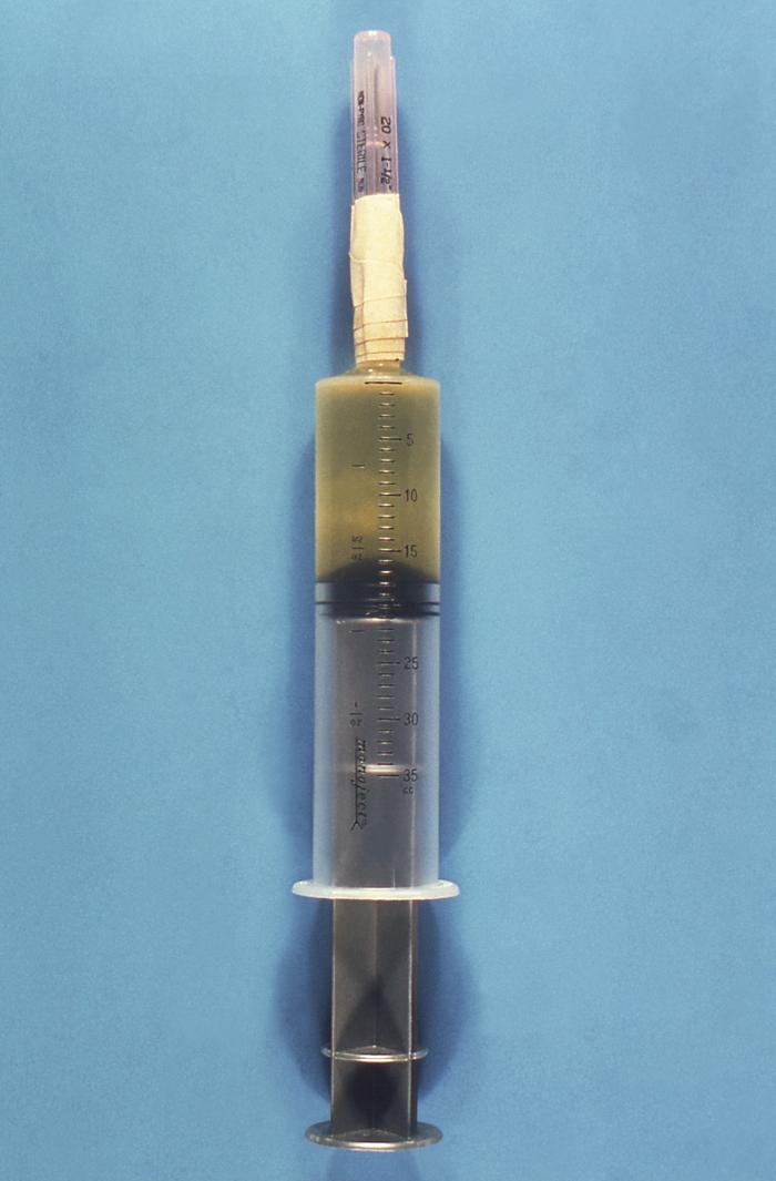 Details - Public Health Image Library(PHIL)