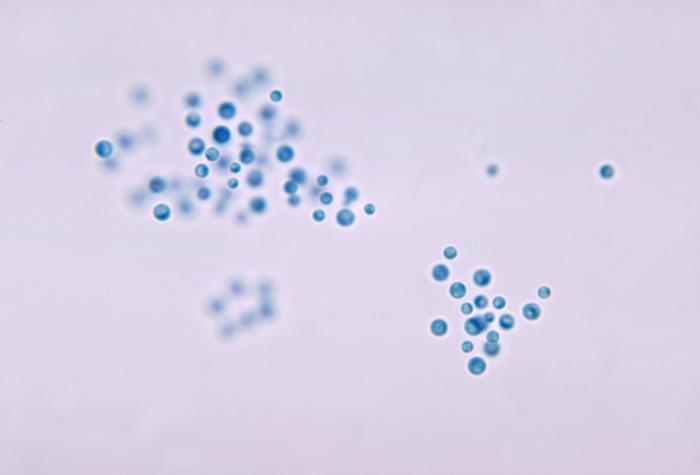 Details - Public Health Image Library(PHIL)