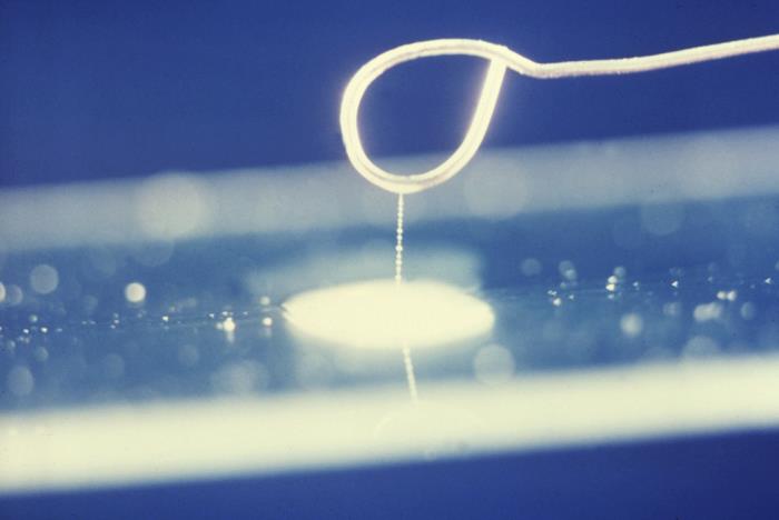 Lab String Details - Public Health Image Library(PHIL)