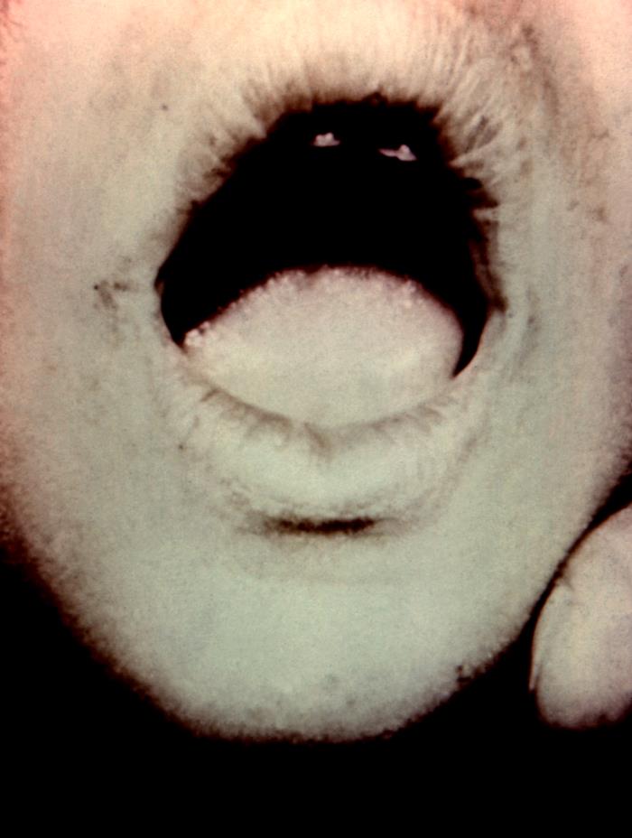 Details - Public Health Image Library(PHIL)