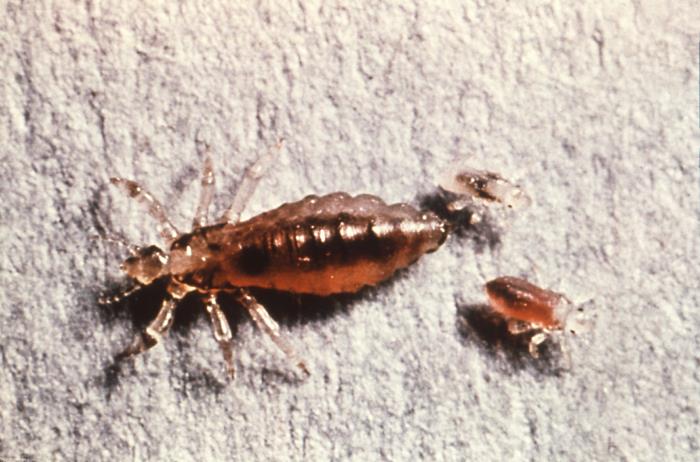 Lou's Insect Details - Public Health Image Library(PHIL)