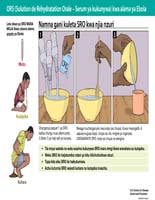 ORS (Oral Rehydration Solution – Kiyeyusho cha Kurejesha Maji Mwilini kwa Kunywa) kwa Dalili za Ebola