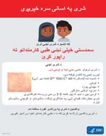 شری په اسانۍ سره خپریږي