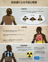 放射線による汚染と曝露